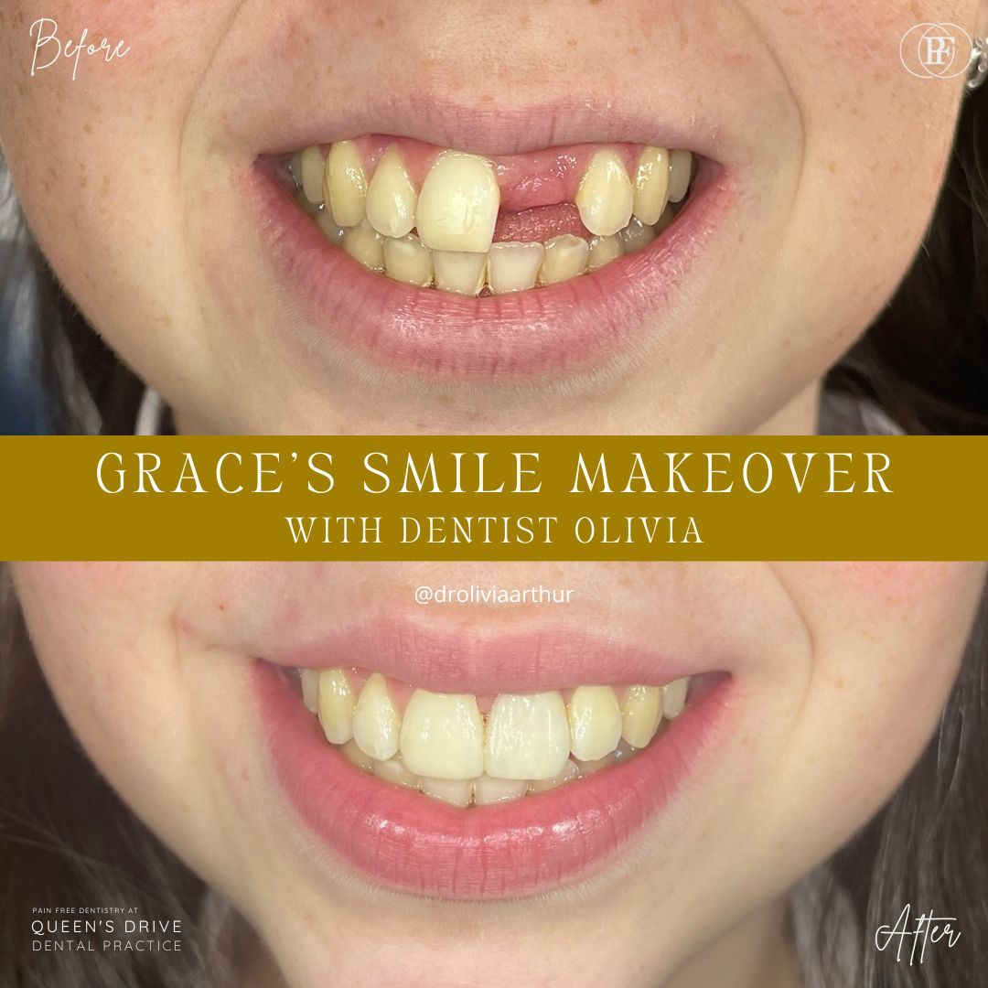 Grace's smile story