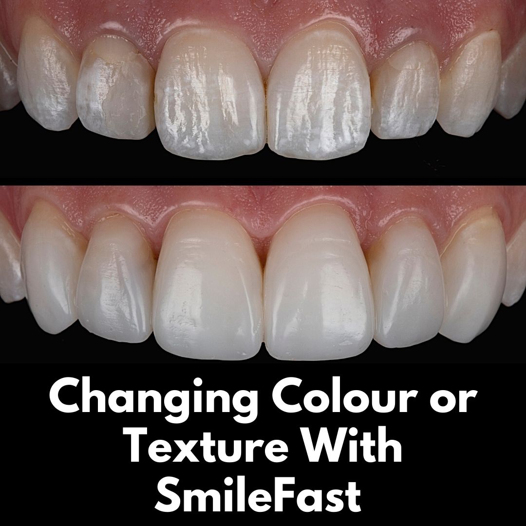 Queens Drive Dental Practice | SmileFast