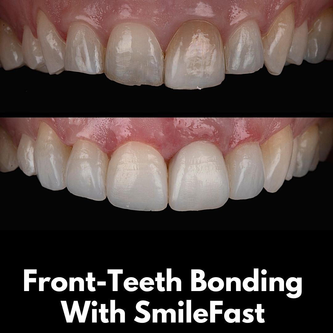 Queens Drive Dental Practice | SmileFast