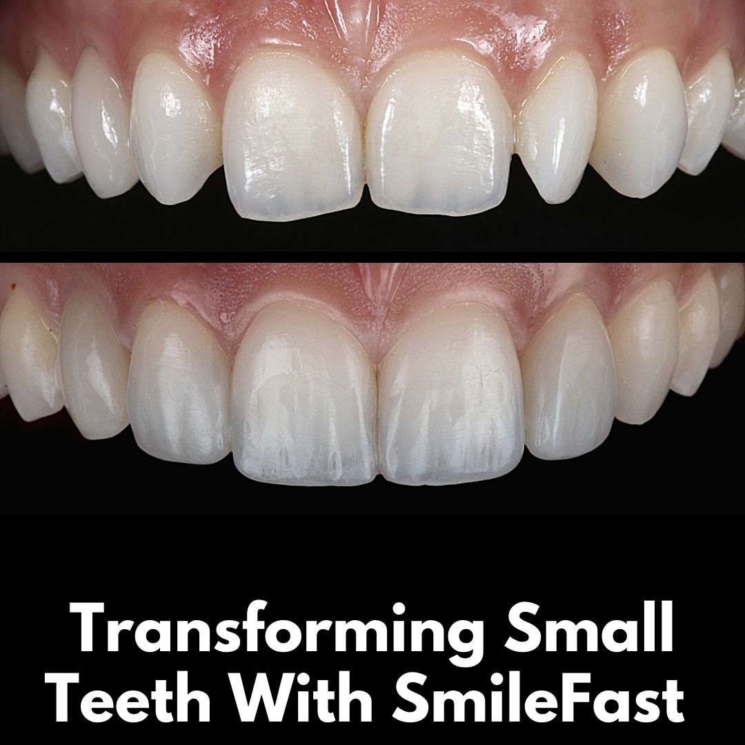 Queens Drive Dental Practice | SmileFast