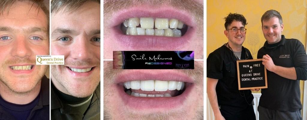 Queens Drive Dental Practice | Smile Makeovers Glasgow What Is SmileFast?