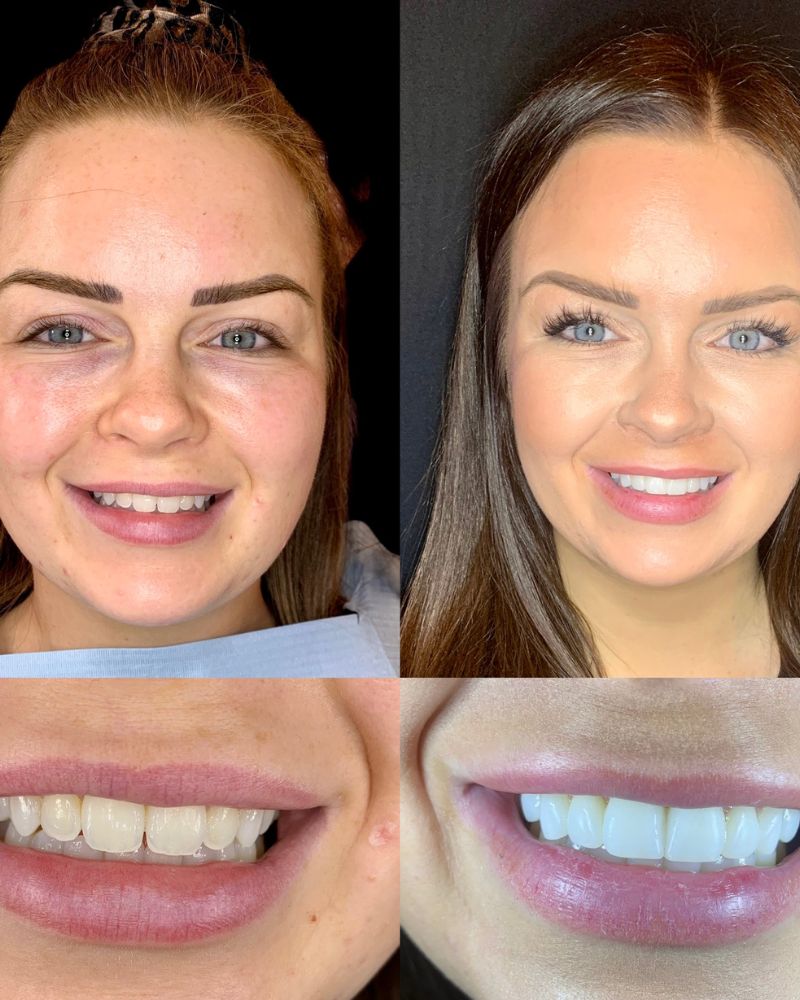 Queens Drive Dental Practice | John Paul Delaney Before & after treatment with John Paul