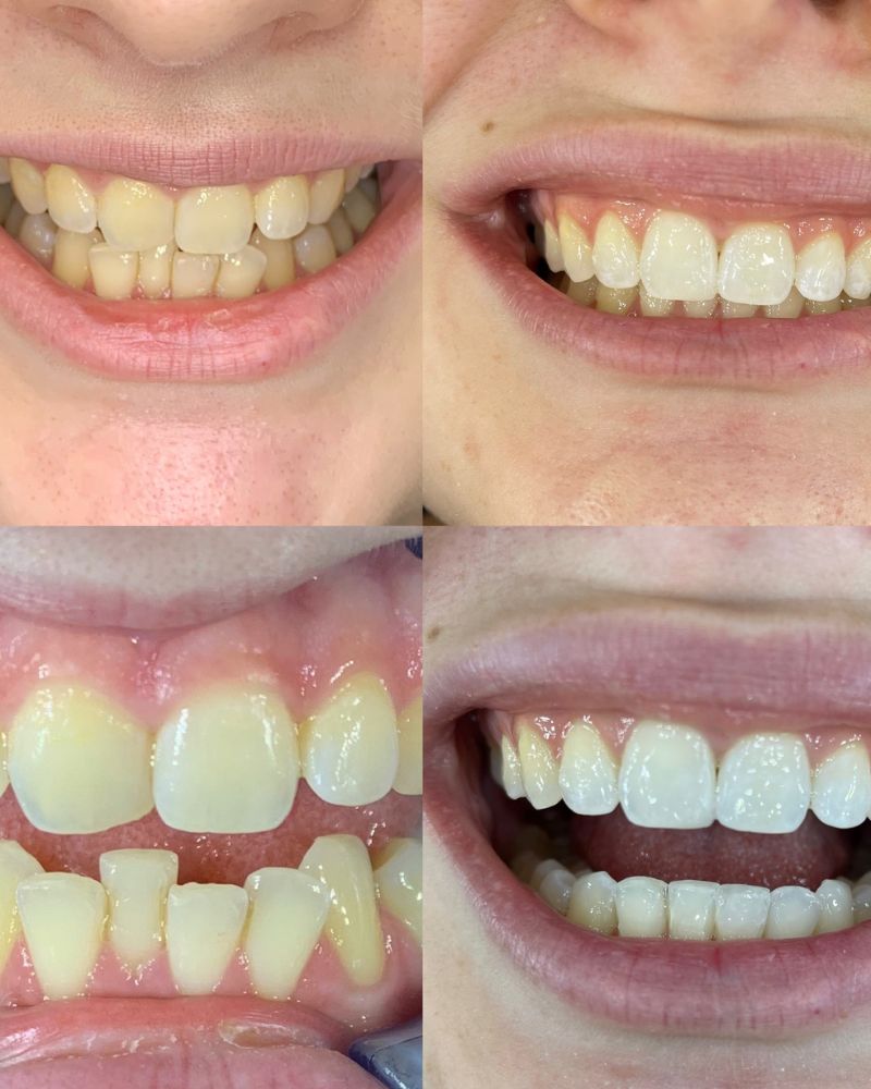 Queens Drive Dental Practice | John Paul Delaney Before & after treatment with John Paul