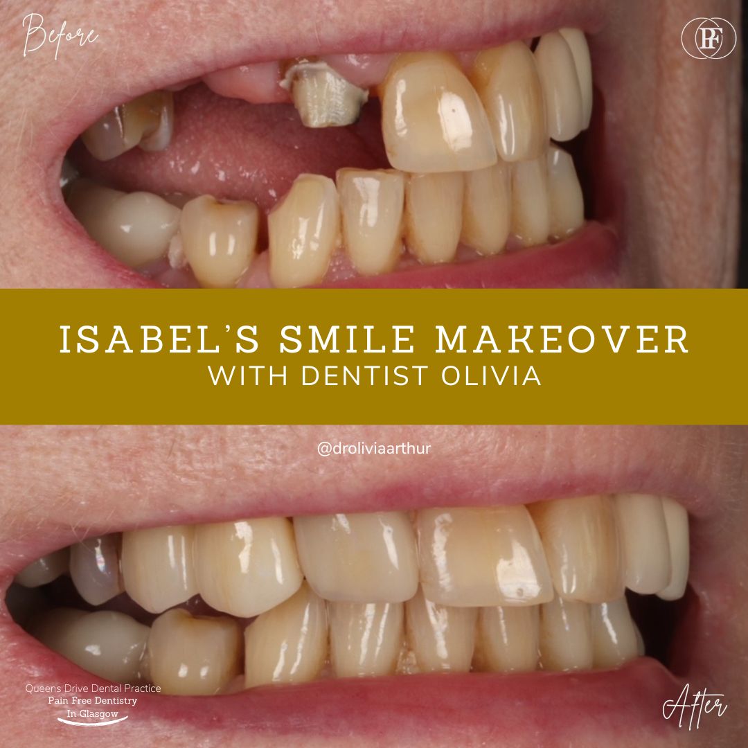 Queens Drive Dental Practice | Isabel's Smile Story