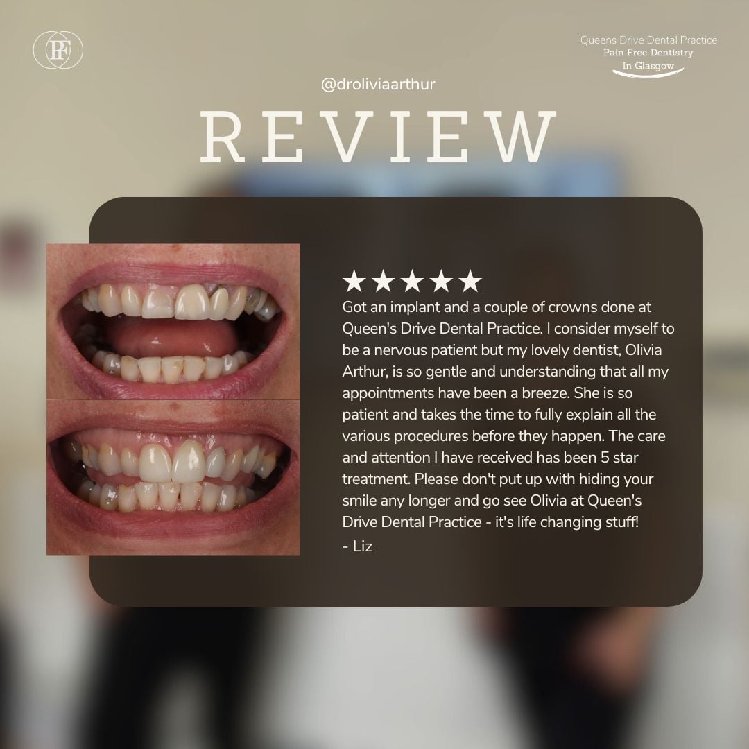 Smile makeover patient story at Queens Drive Glasgow