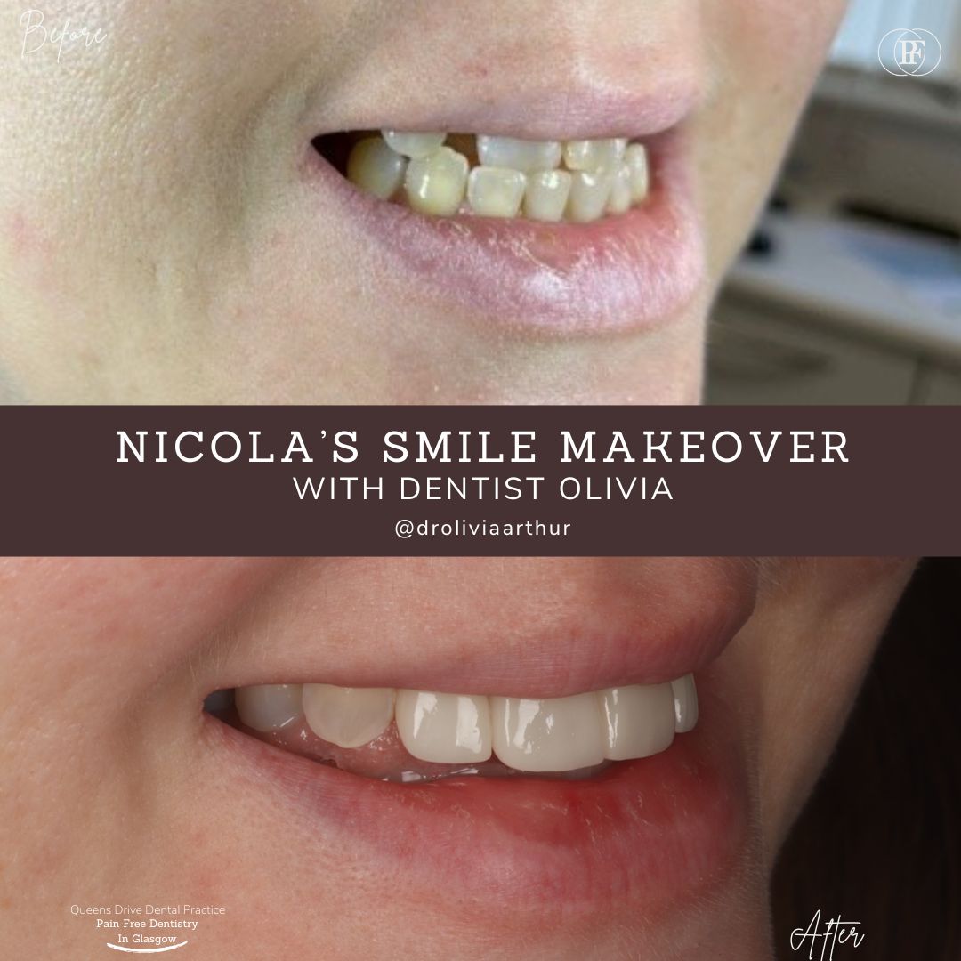Queens Drive Dental Practice | Nicola's Smile Story