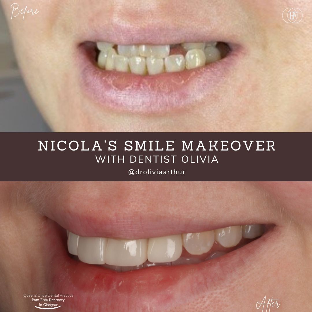 Queens Drive Dental Practice | Nicola's Smile Story