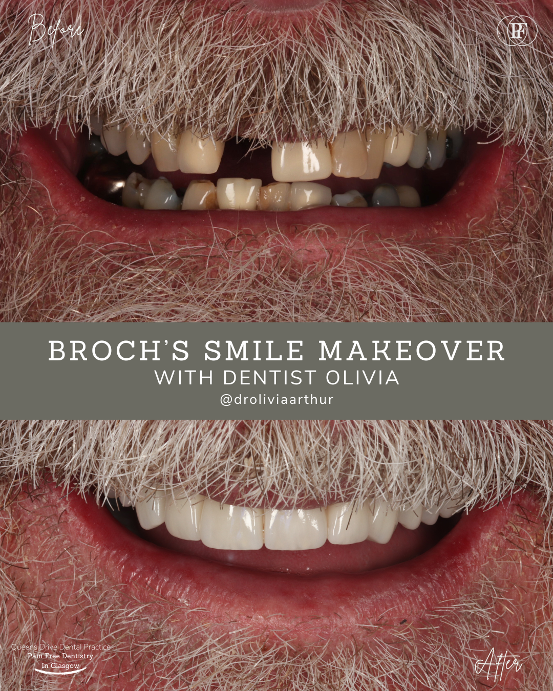Queens Drive Dental Practice | Broch´s Smile Story Ross's Smile Story with Andy