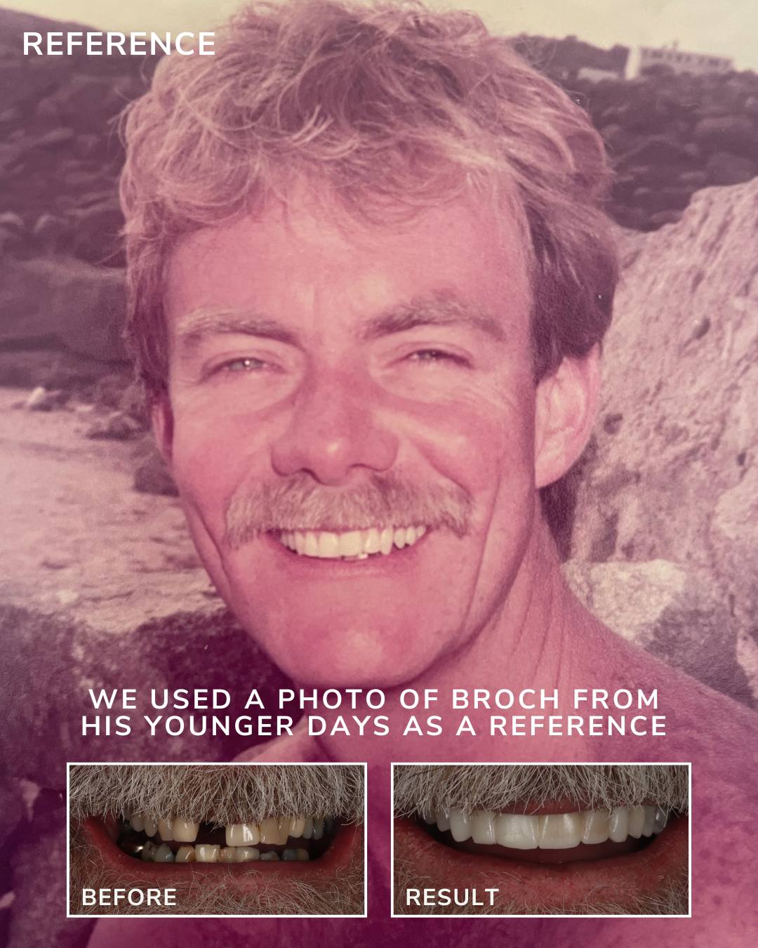 Queens Drive Dental Practice | Broch´s Smile Story Ross's Smile Story with Andy
