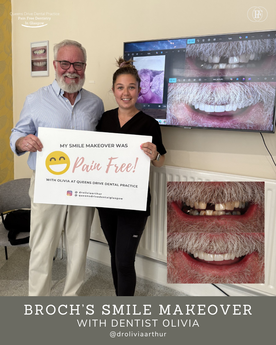 Queens Drive Dental Practice | Broch´s Smile Story Ross's smile story