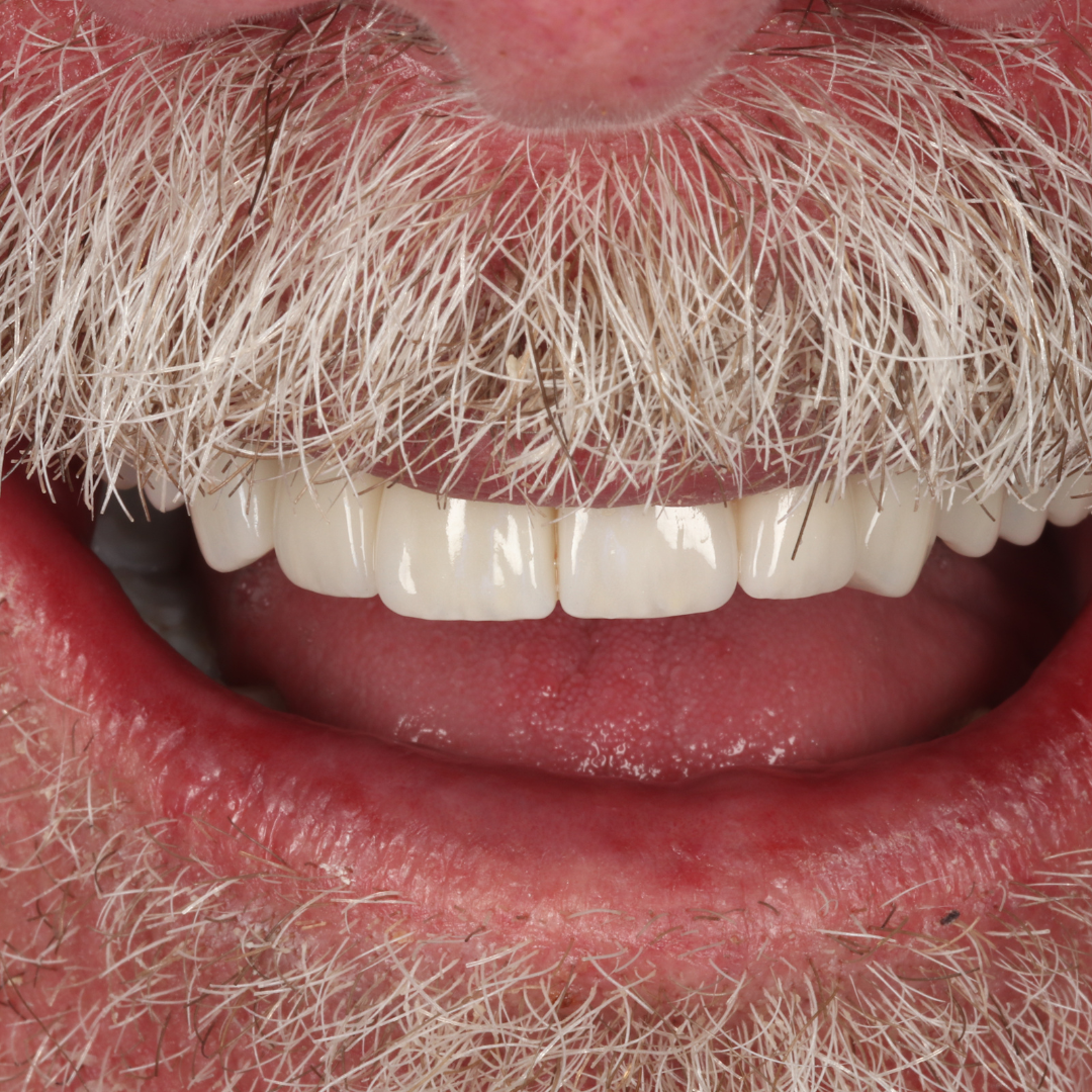 Queens Drive Dental Practice | Broch´s Smile Story Queens Drive Dental Practice | Broch´s Smile Story
