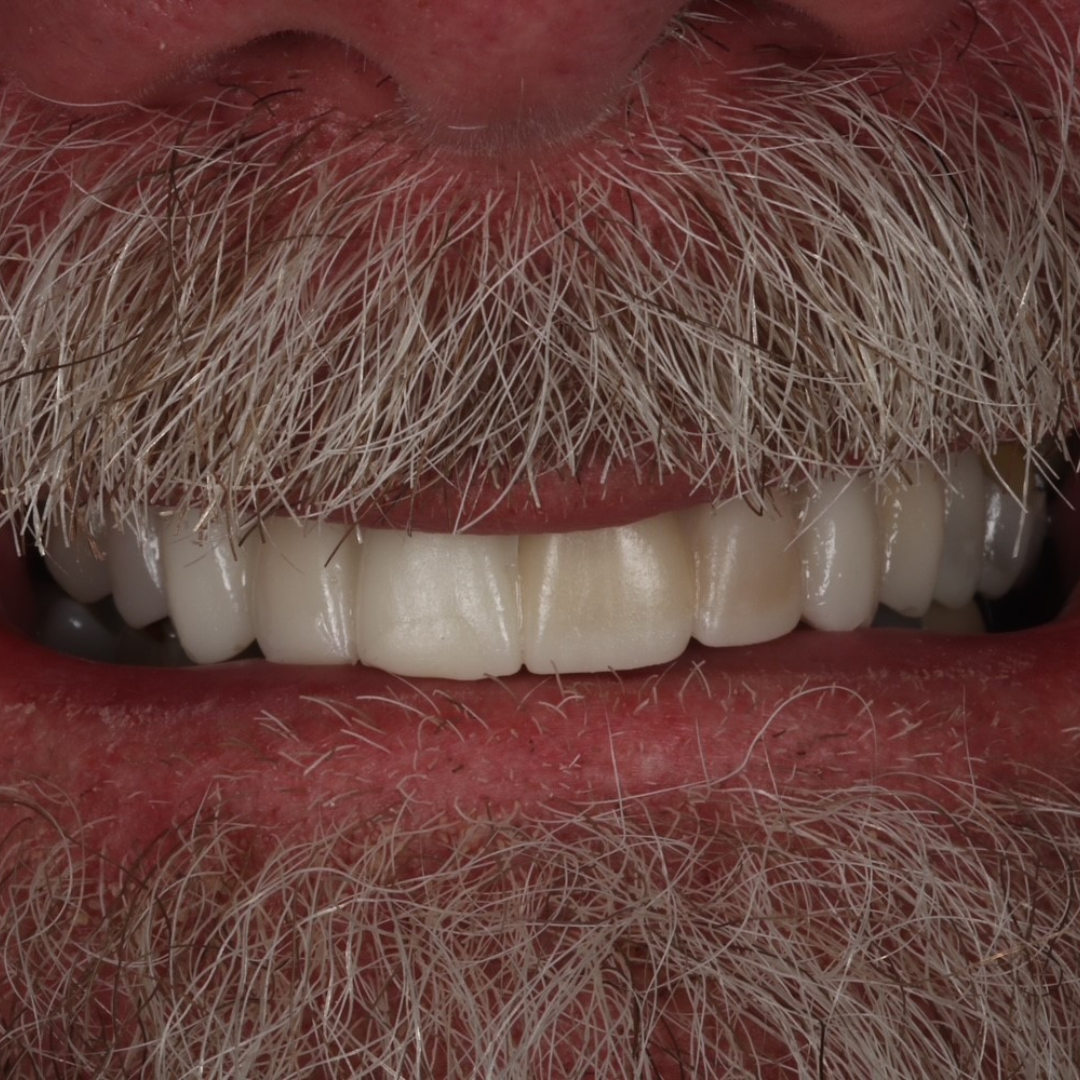 Queens Drive Dental Practice | Broch´s Smile Story Queens Drive Dental Practice | Broch´s Smile Story