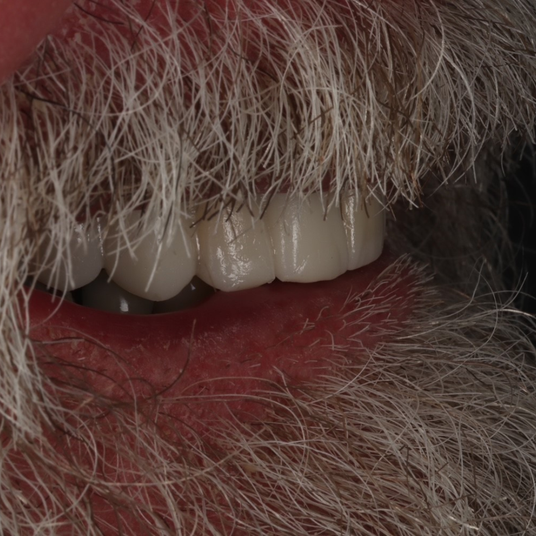 Queens Drive Dental Practice | Broch´s Smile Story Queens Drive Dental Practice | Broch´s Smile Story