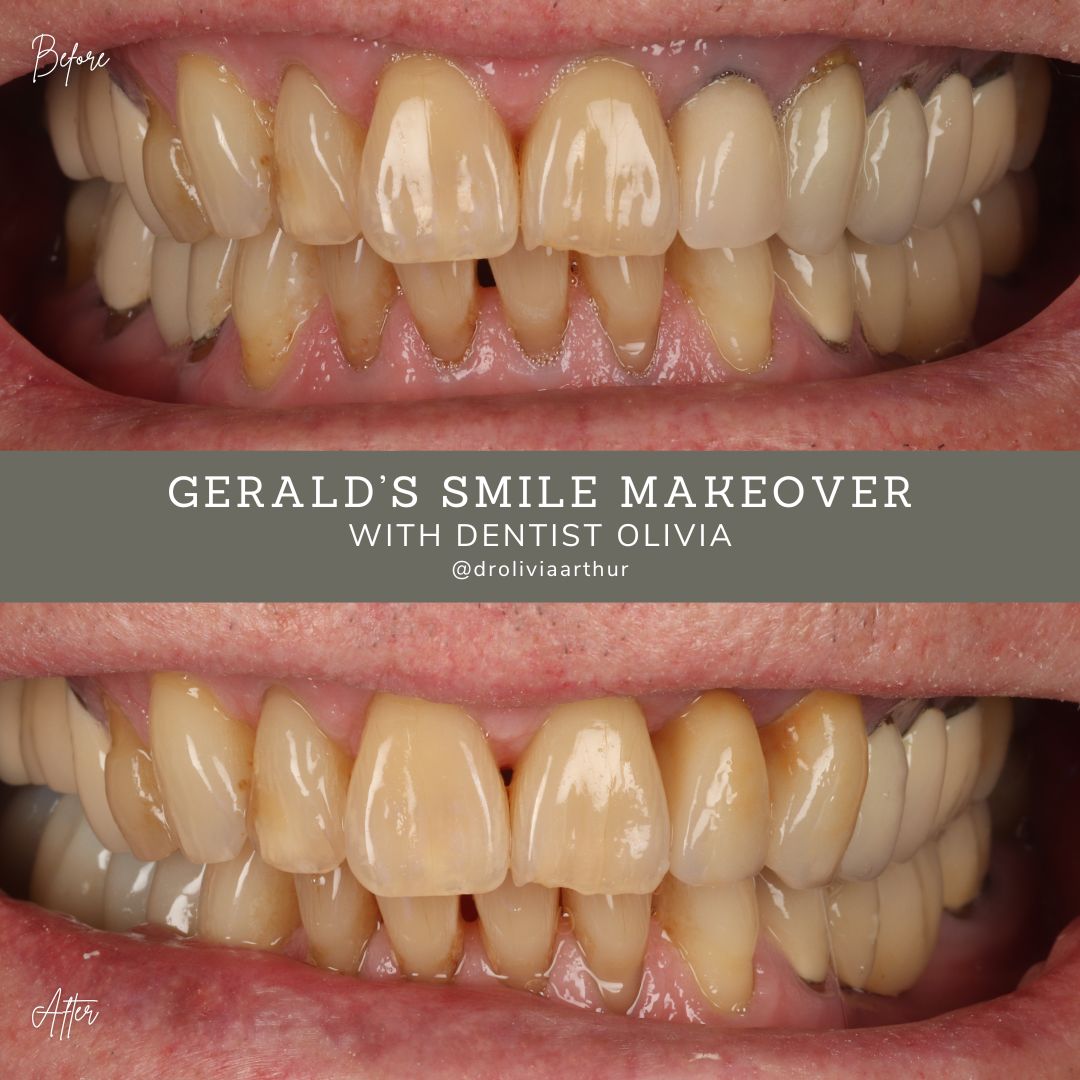 Gerald's Smile Story - Olivia (1080 x 1080 px) (1)