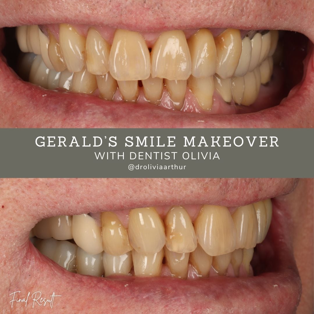 Queens Drive Dental Practice | Gerald's Smile Story