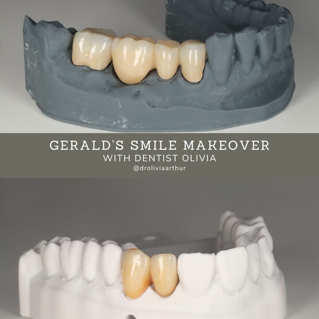 Gerald's Smile Story - Olivia (1080 x 1080 px) (1)