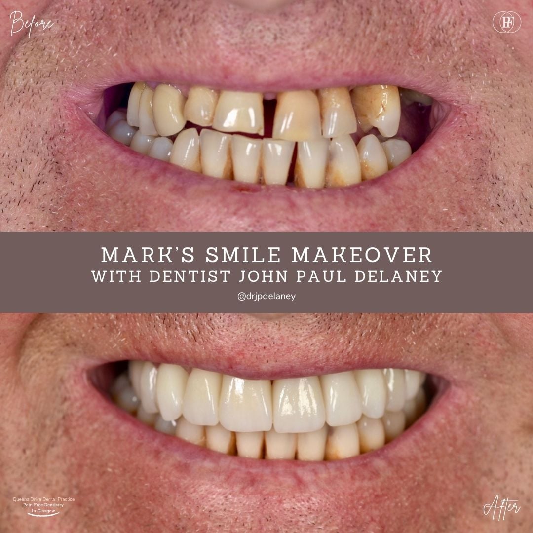 Mark's Smile Story - John (1080 x 1080 px) (1)