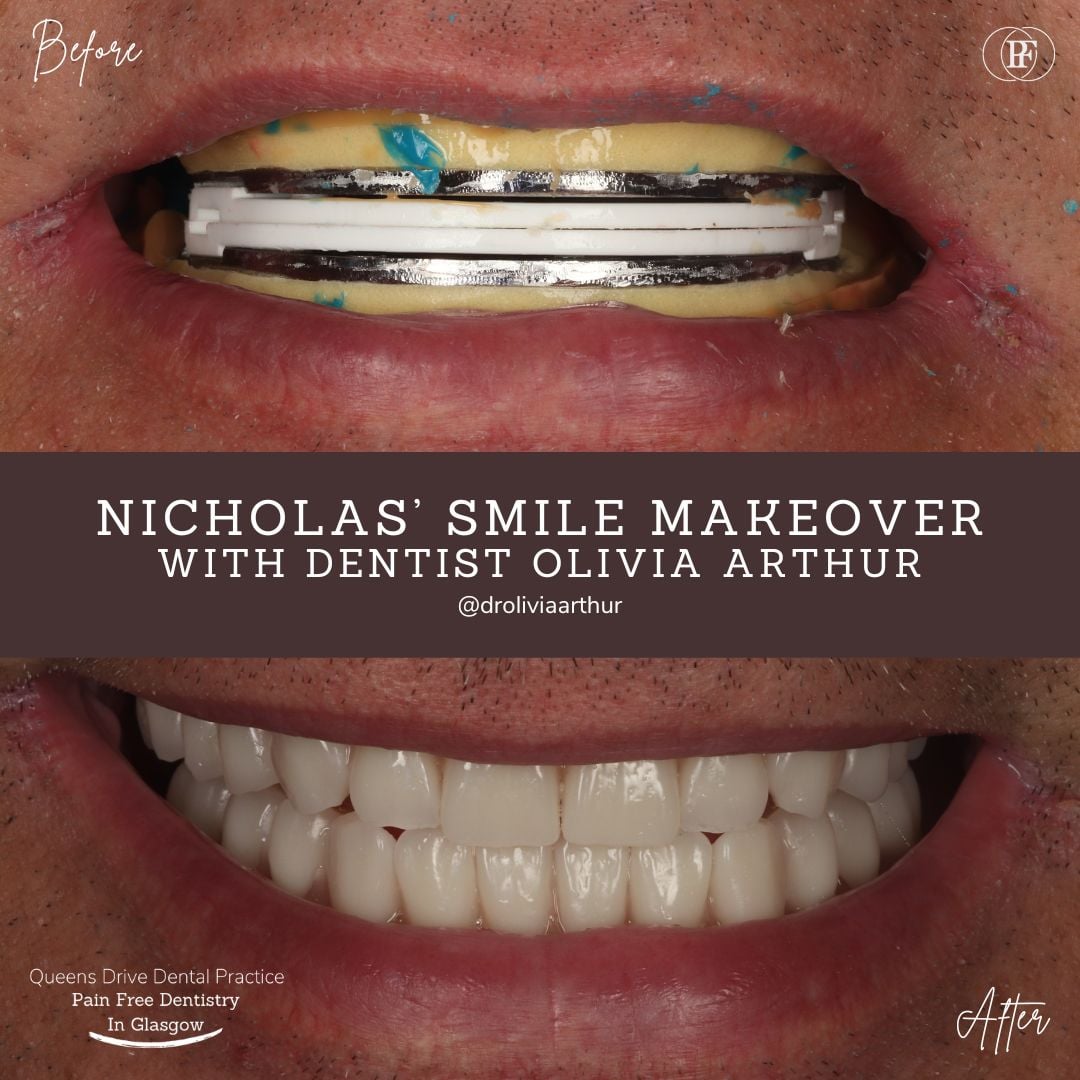 Gerald's Smile Story - Olivia (1080 x 1080 px) (1)
