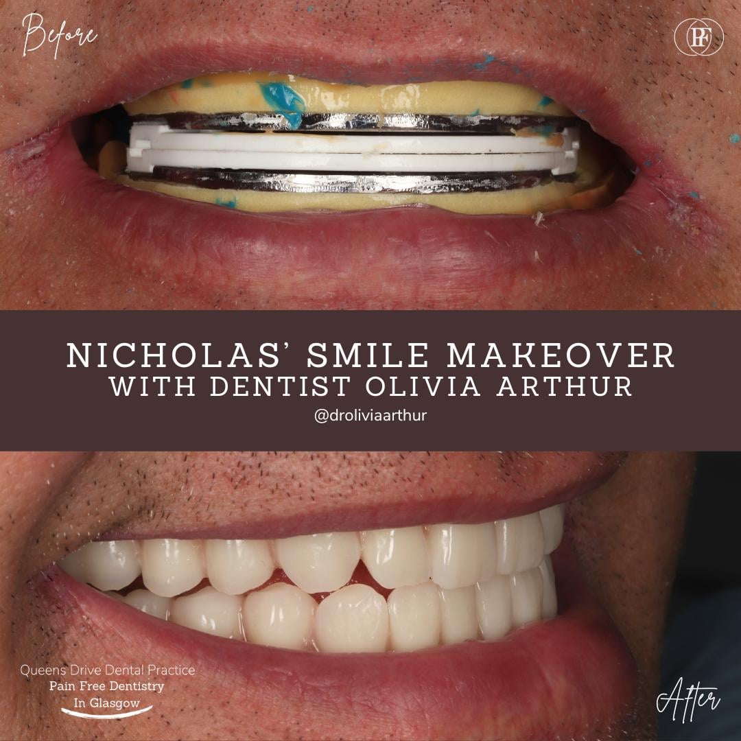 Queens Drive Dental Practice | Nicholas' Smile Story