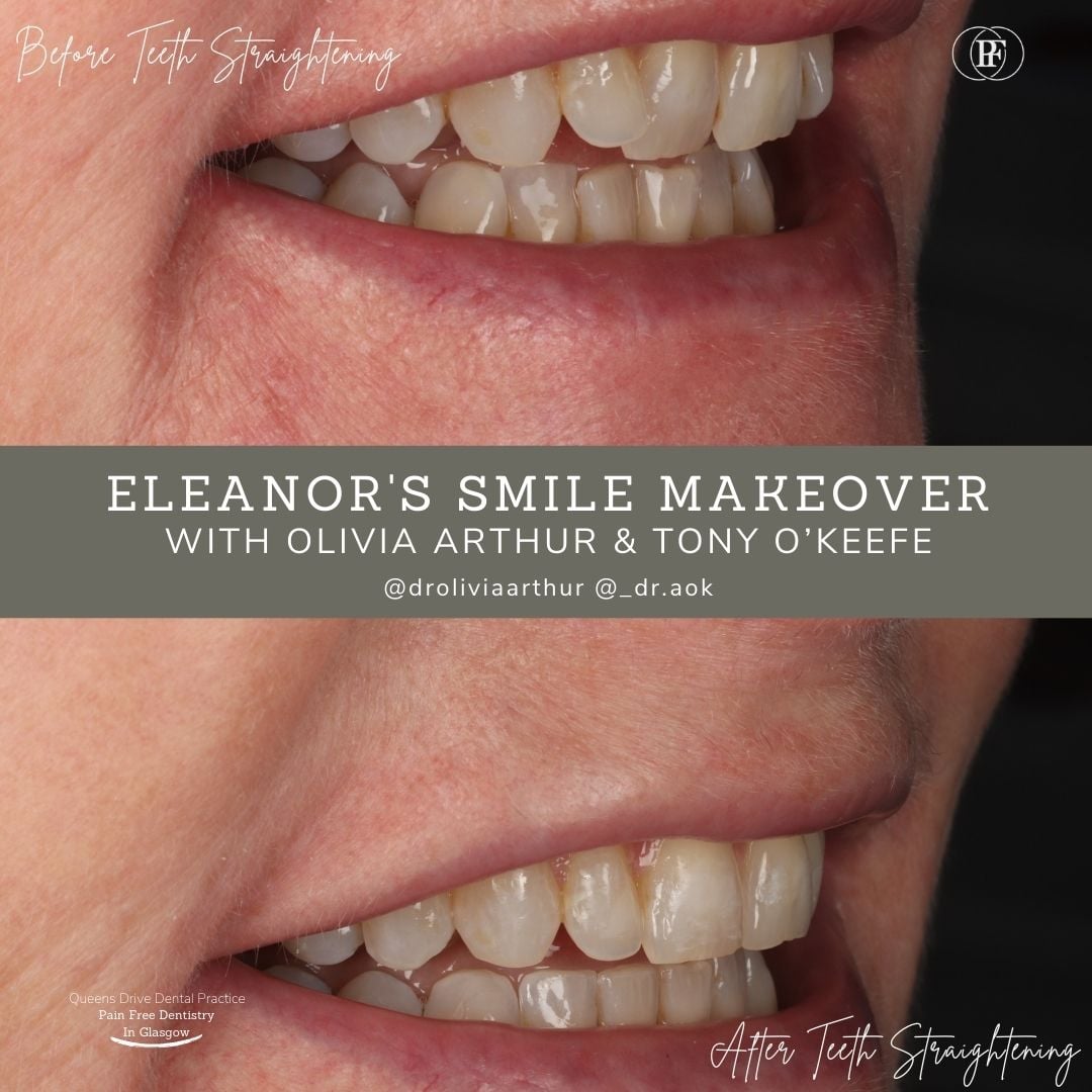 Queens Drive Dental Practice | Eleanor's Smile Story Queens Drive Dental Practice | Eleanor's Smile Story