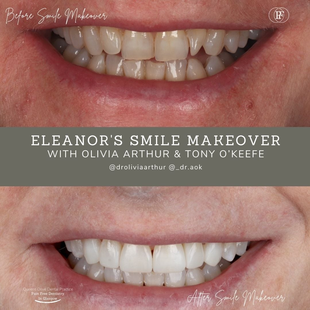 Queens Drive Dental Practice | Eleanor's Smile Story Gerald's Smile Story - Olivia (1080 x 1080 px)