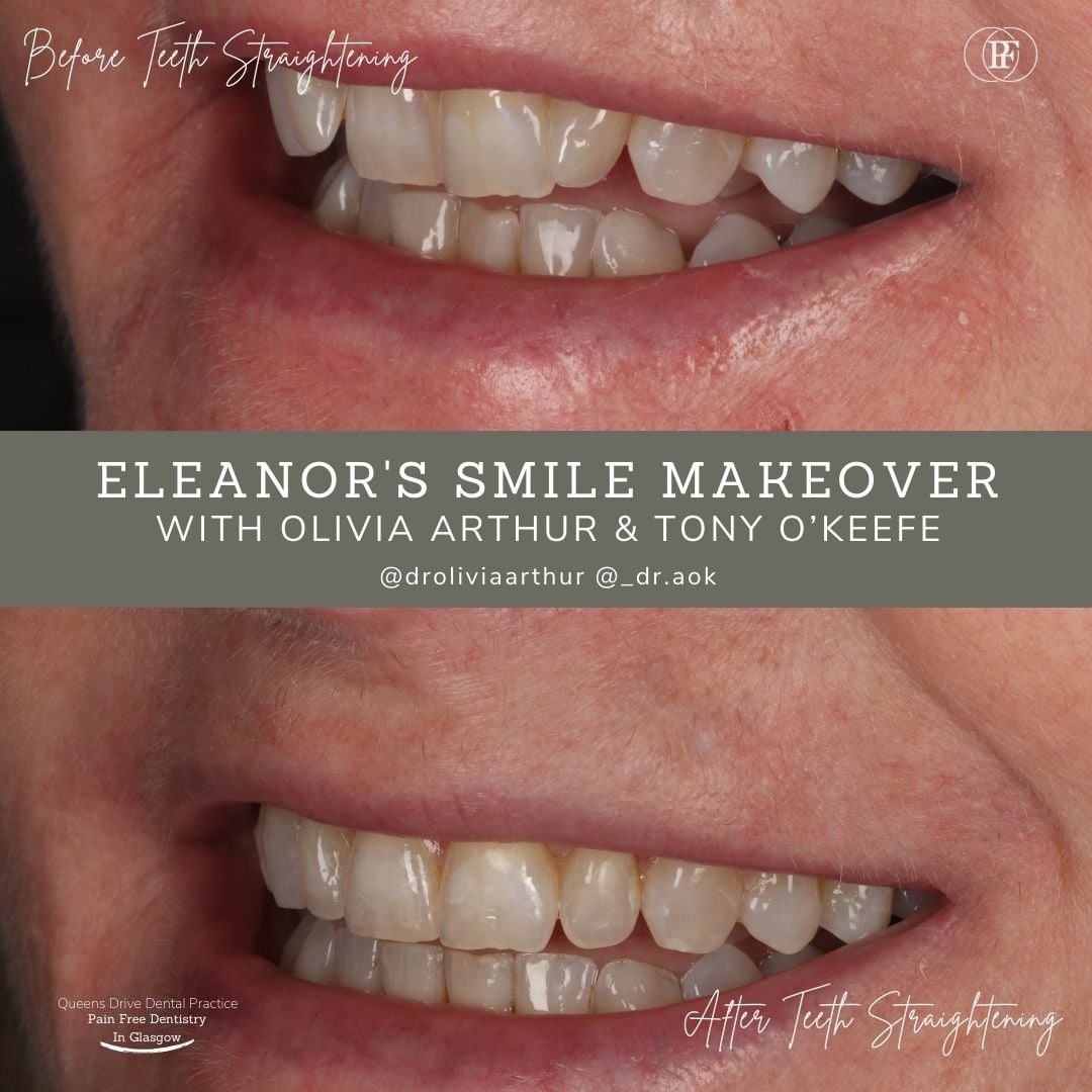Queens Drive Dental Practice | Eleanor's Smile Story Nichola's Smile Story - Olivia (1080 x 1080 px) (1)