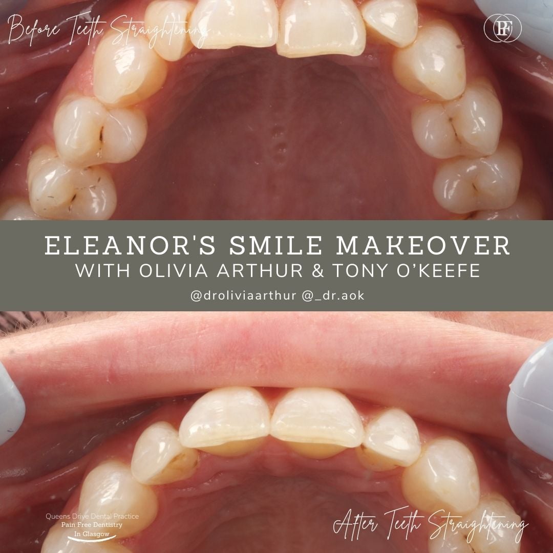 Queens Drive Dental Practice | Eleanor's Smile Story Gerald's Smile Story - Olivia (1080 x 1080 px) (1)