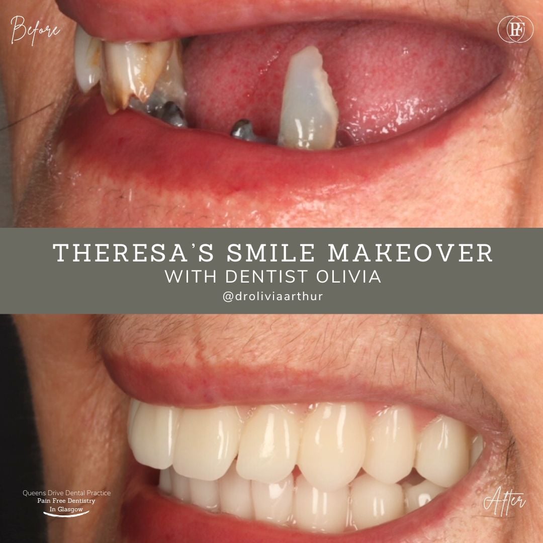 Theresas smile story QD