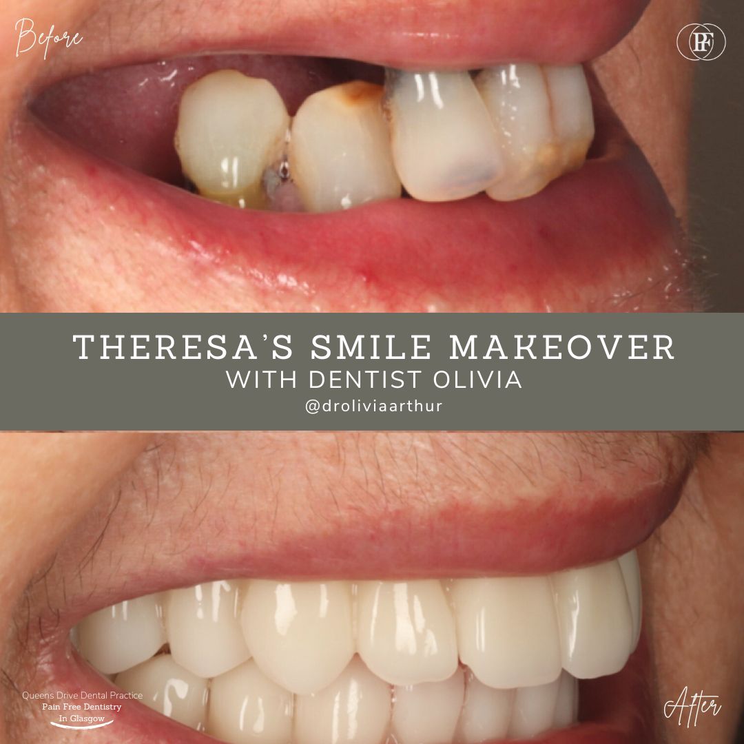 Theresas smile story QD