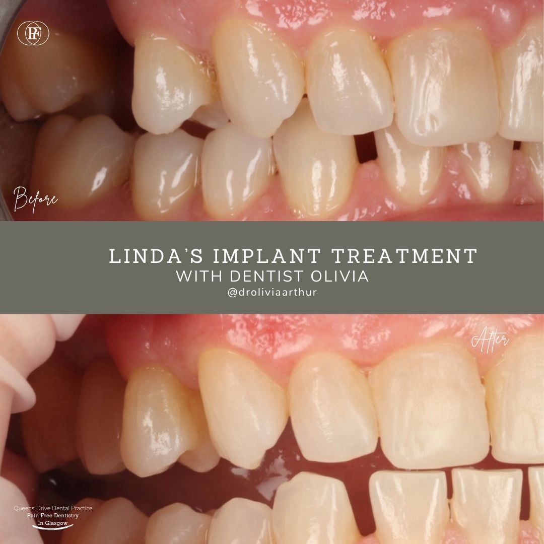 Queens Drive Dental Practice | Linda's Smile Story Linda's Smile Story - Olivia (1080 x 1080 px)