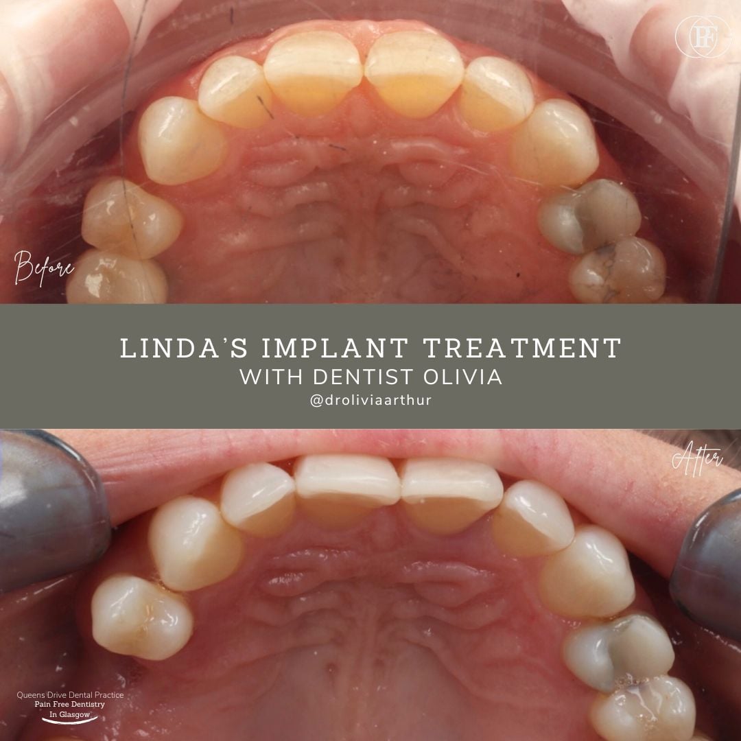 Queens Drive Dental Practice | Linda's Smile Story Linda's Smile Story - Olivia (1080 x 1080 px)