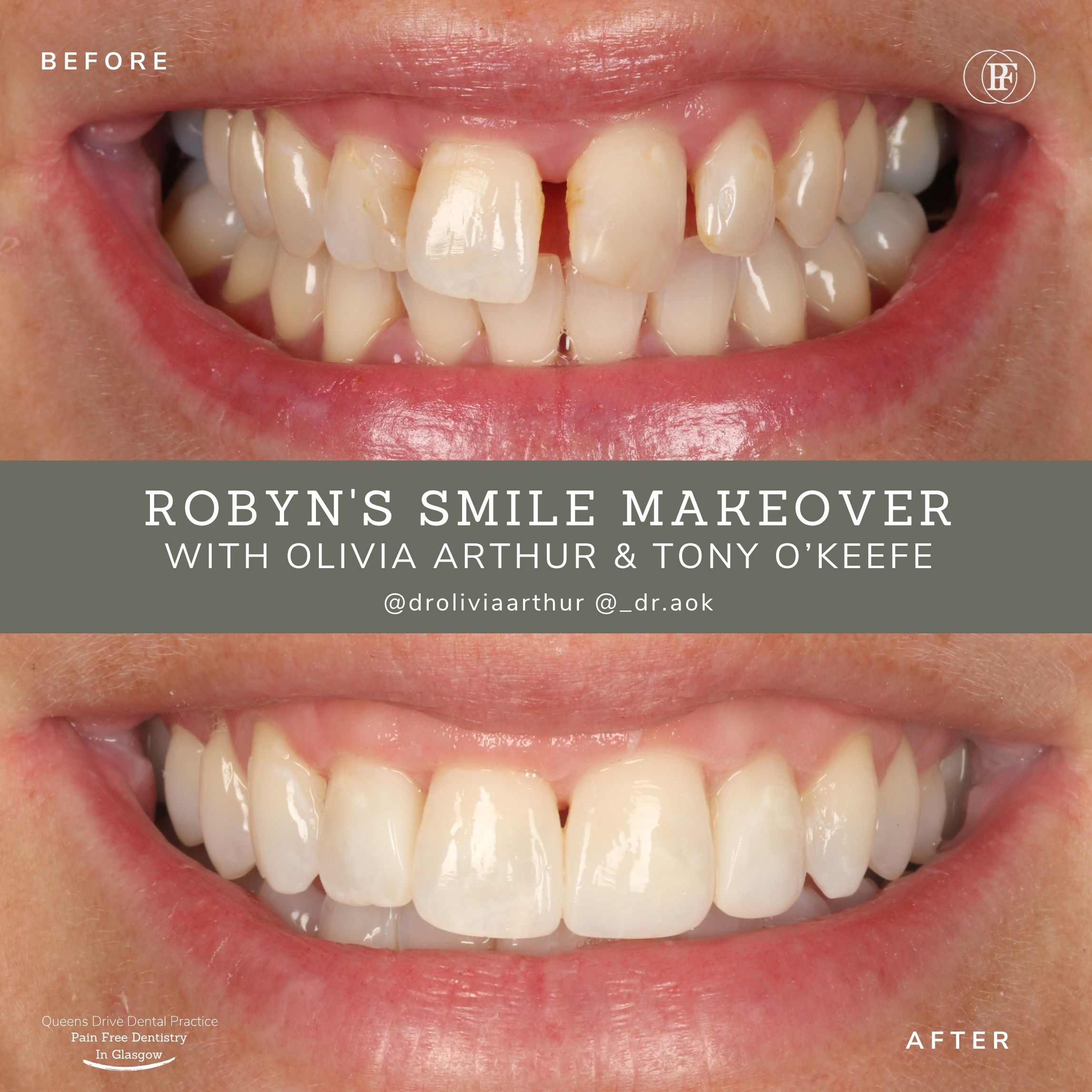 Robyn's Smile Story | Robyns Smile Story Olivia Arthur And Tony Okeefe 1080 X 1080 Px 1