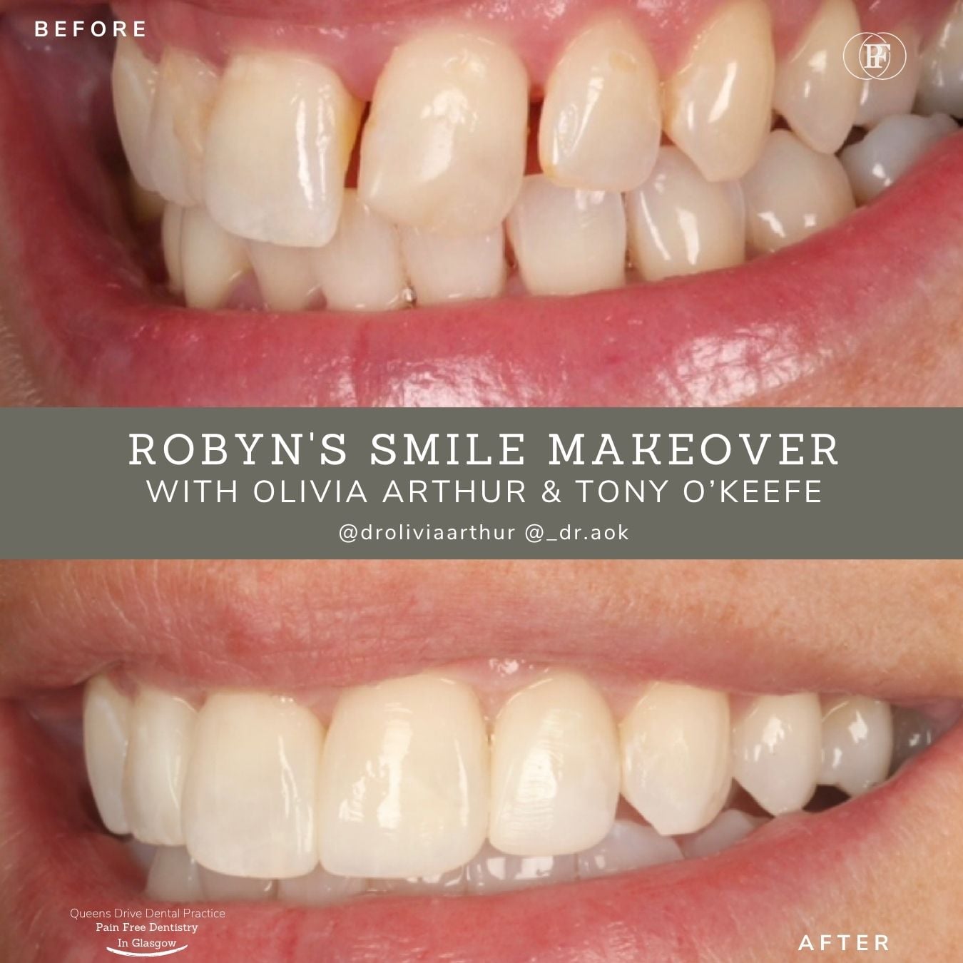 Gerald's Smile Story - Olivia (1080 x 1080 px) (1)