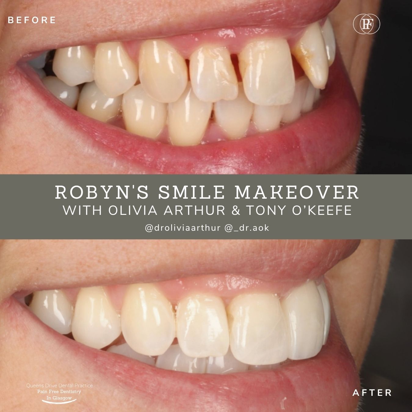 Robyn's Smile Story | Robyns Smile Story Olivia Arthur And Tony Okeefe 1080 X 1080 Px 3 1