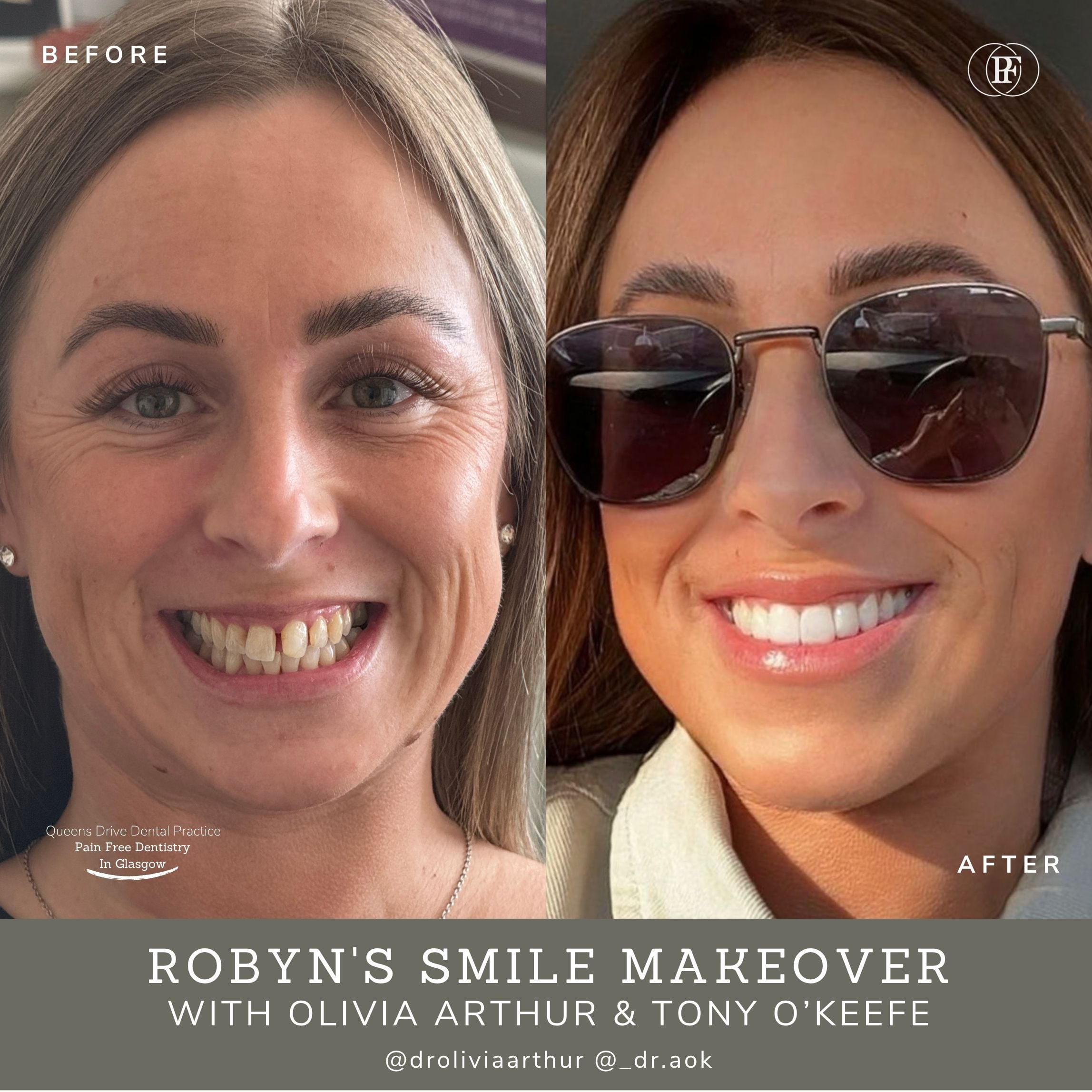 Robyns-Smile-Story-Olivia-Arthur-and-Tony-OKeefe Queens Drive Dental Practice Glasgow