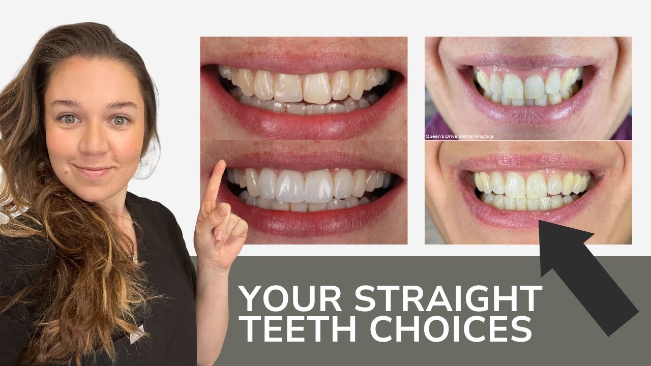 Smile Design in Glasgow