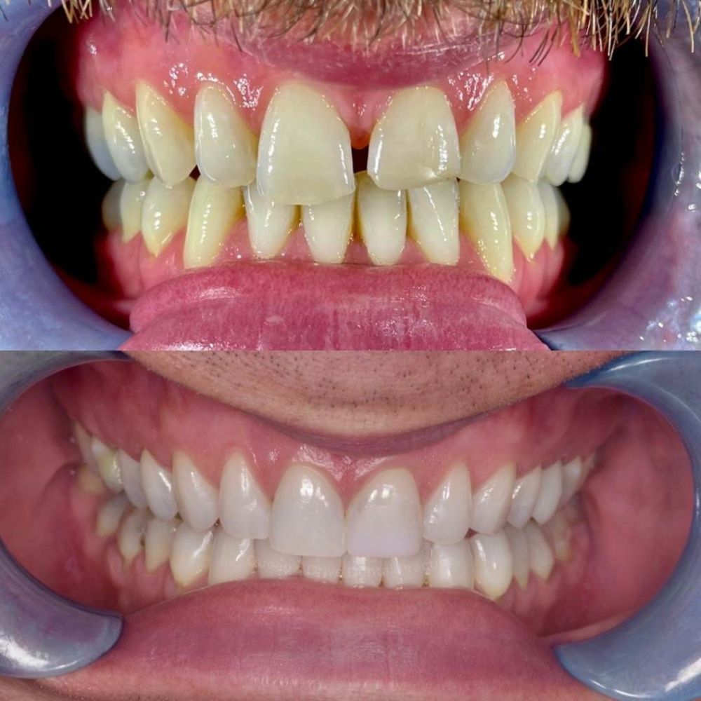 Queens Drive Dental Practice | Smile Gallery Queens Drive Dental Practice | Smile Gallery