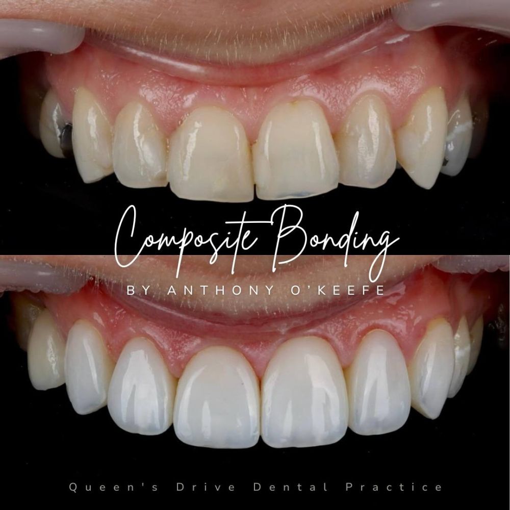 Queens Drive Dental Practice | Smile Gallery Queens Drive Dental Practice | Smile Gallery