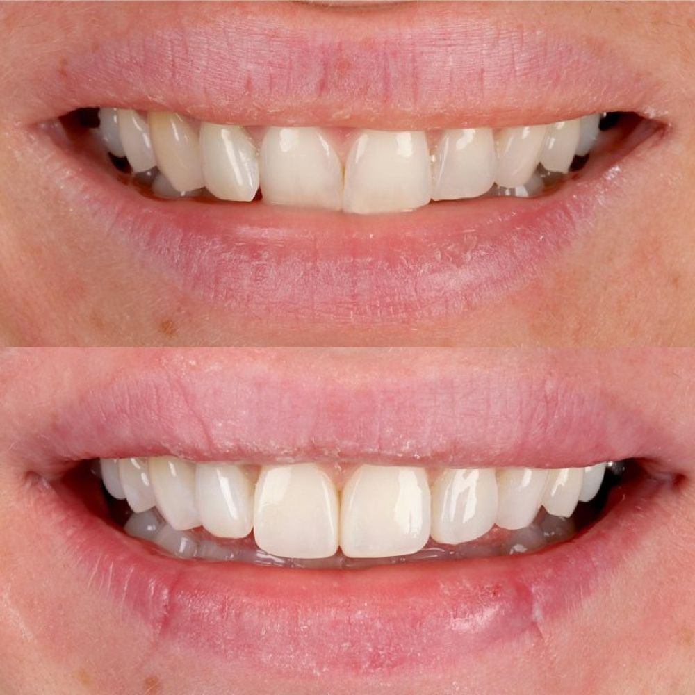 Queens Drive Dental Practice | Smile Gallery Queens Drive Dental Practice | Smile Gallery
