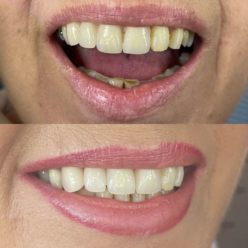 Queens Drive Dental Practice | Smile Gallery Queens Drive Dental Practice | Smile Gallery