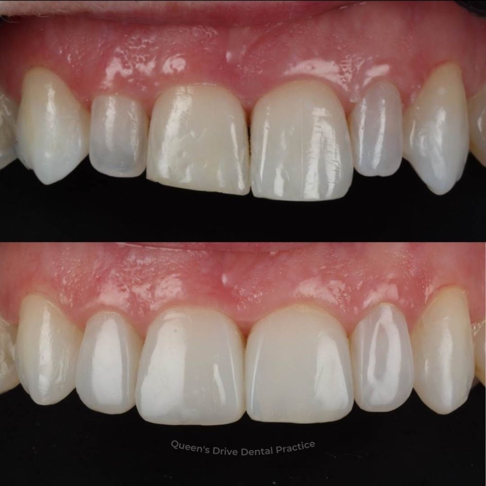 Queens Drive Dental Practice | Smile Gallery Queens Drive Dental Practice | Smile Gallery