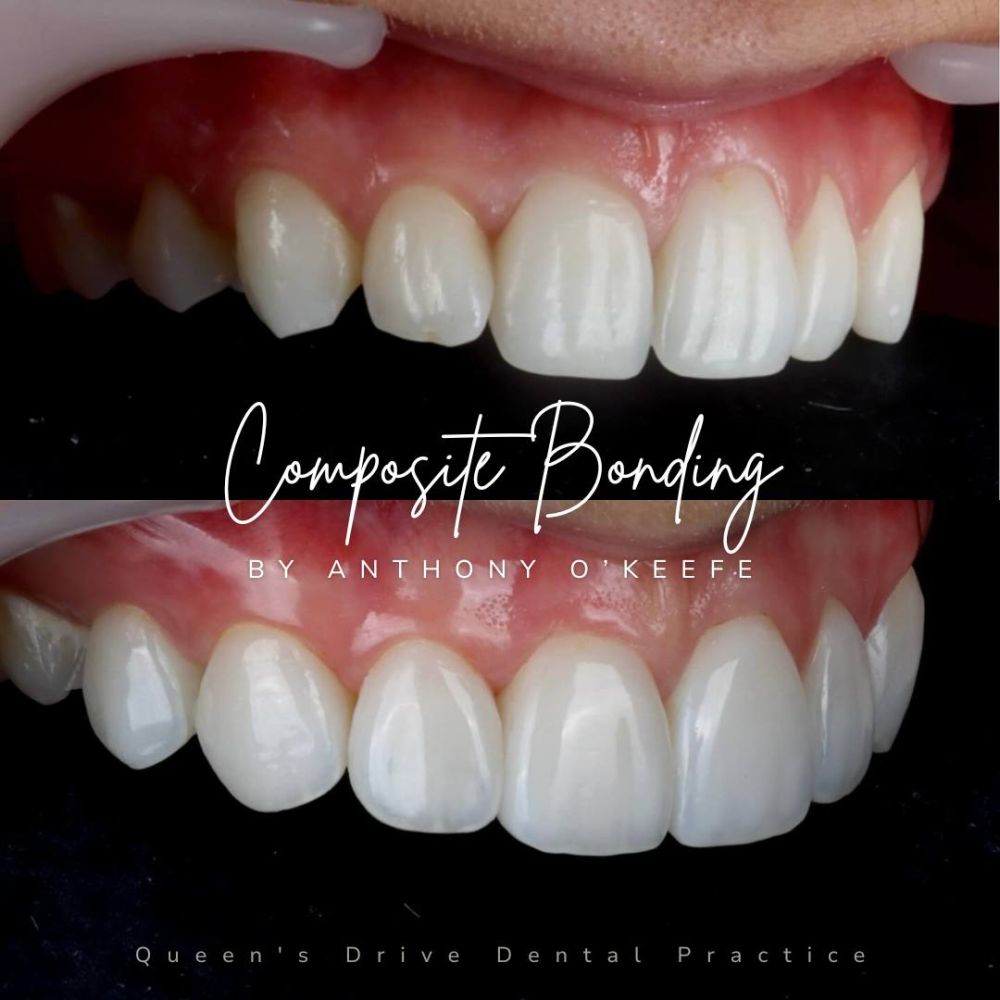 Queens Drive Dental Practice | Smile Gallery Queens Drive Dental Practice | Smile Gallery