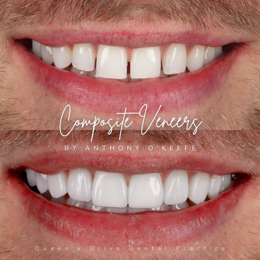 Queens Drive Dental Practice | Smile Gallery Queens Drive Dental Practice | Smile Gallery