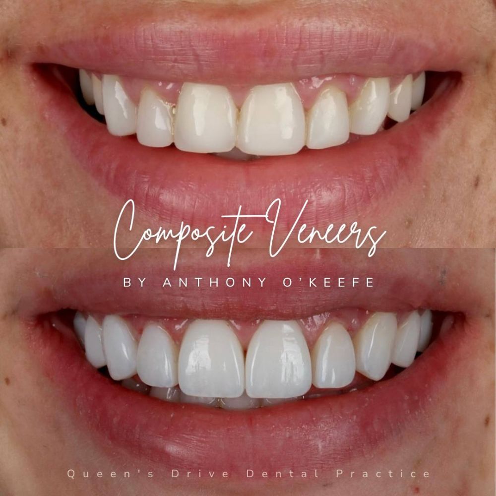 Queens Drive Dental Practice | Smile Gallery Queens Drive Dental Practice | Smile Gallery