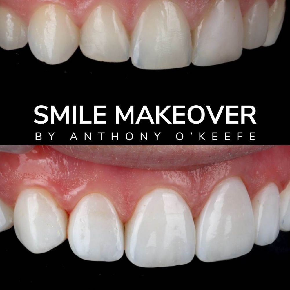 Queens Drive Dental Practice | Smile Gallery Queens Drive Dental Practice | Smile Gallery