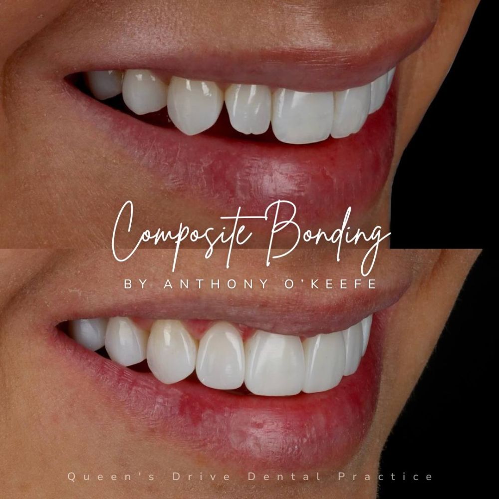 Queens Drive Dental Practice | Smile Gallery Queens Drive Dental Practice | Smile Gallery