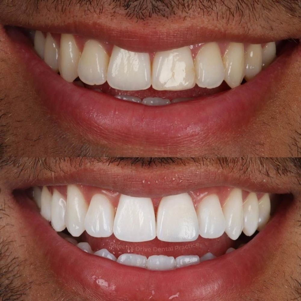Queens Drive Dental Practice | Smile Gallery Queens Drive Dental Practice | Smile Gallery
