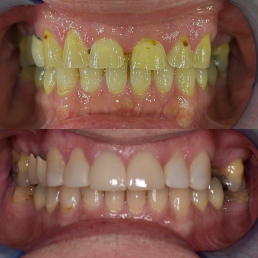 Queens Drive Dental Practice | Smile Gallery Queens Drive Dental Practice | Smile Gallery