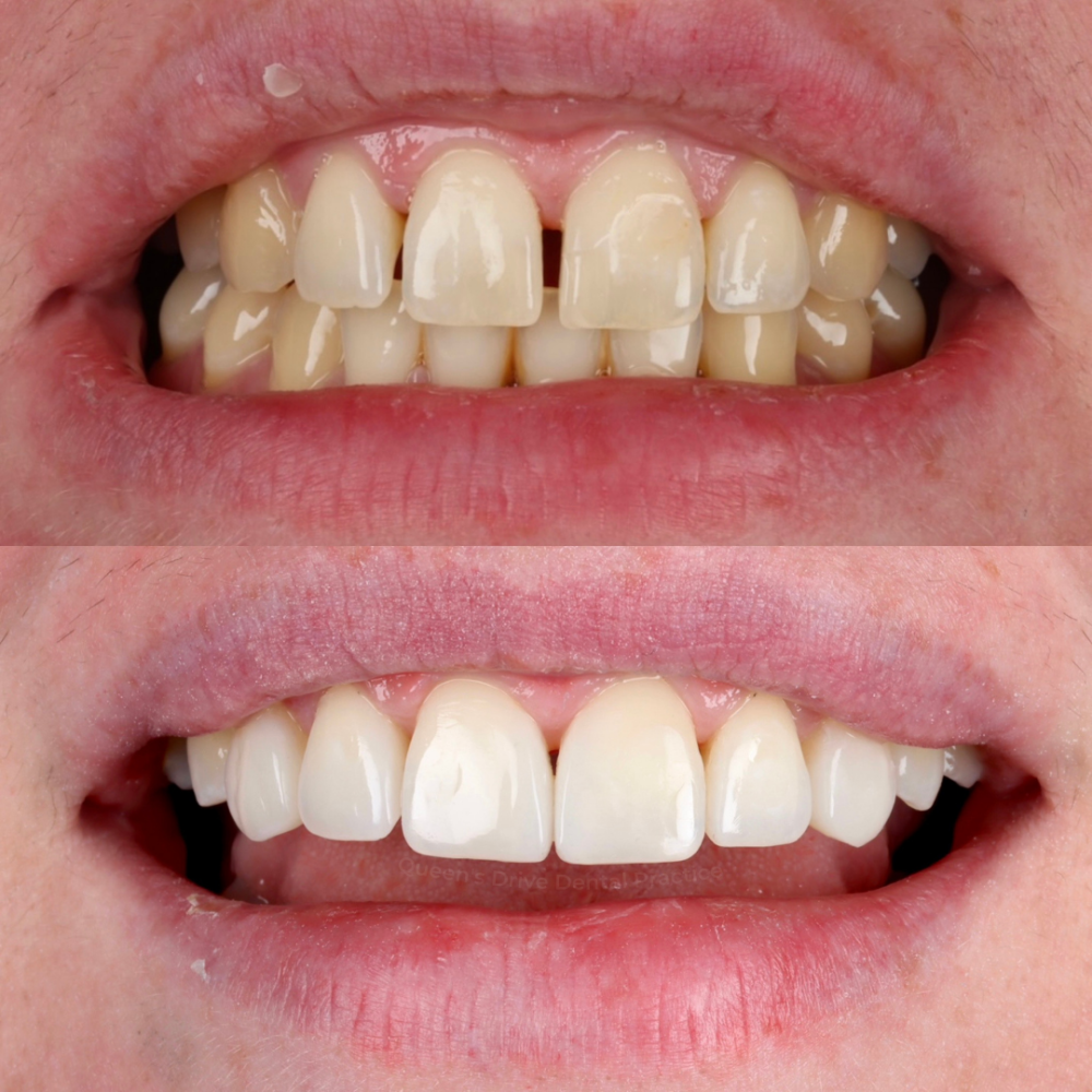 Queens Drive Dental Practice | Smile Gallery Queens Drive Dental Practice | Smile Gallery