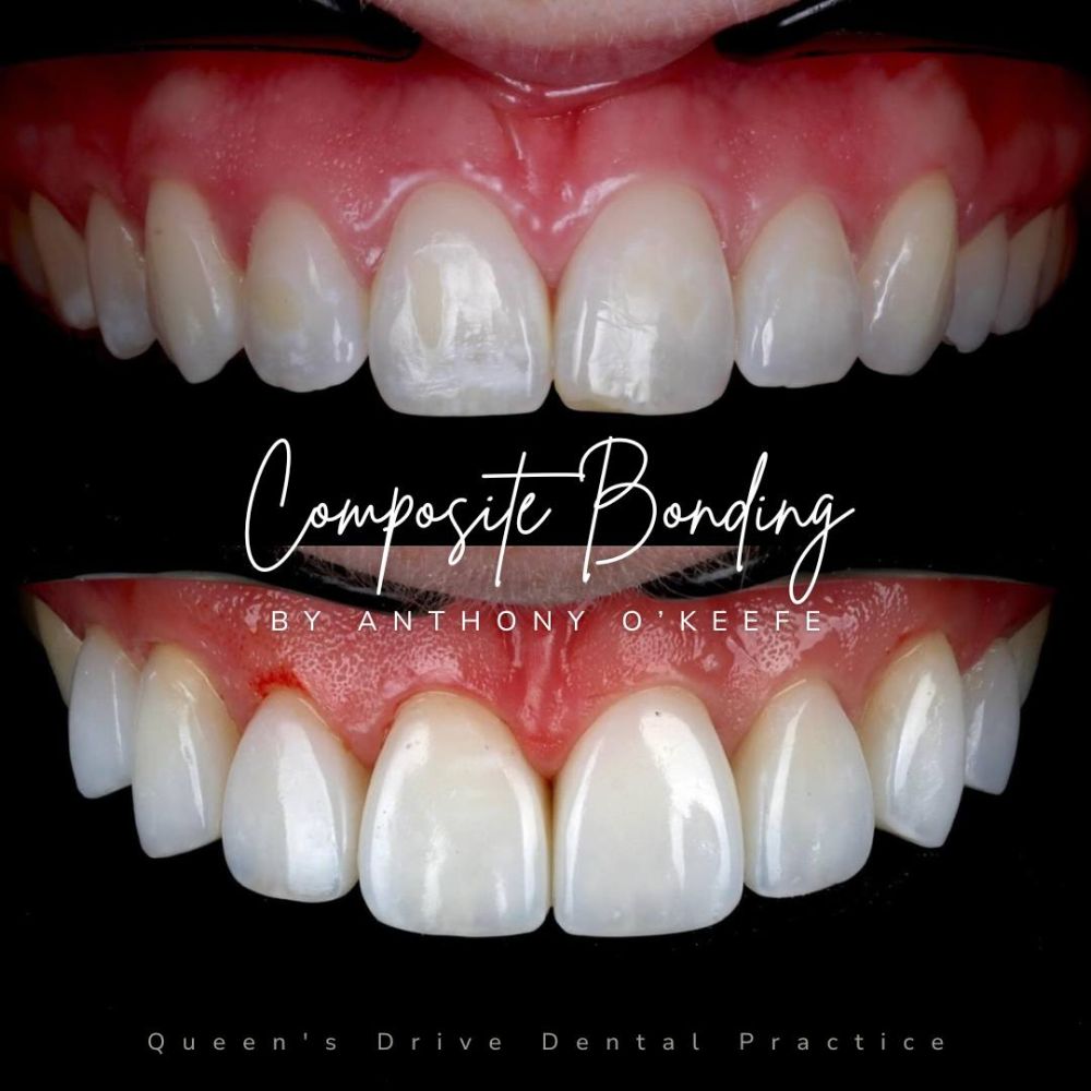 Queens Drive Dental Practice | Smile Gallery Queens Drive Dental Practice | Smile Gallery